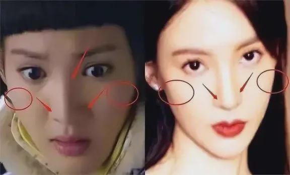 明星无山根,揭秘独特面部特征的美丽魅力